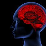 طب المخ والأعصاب